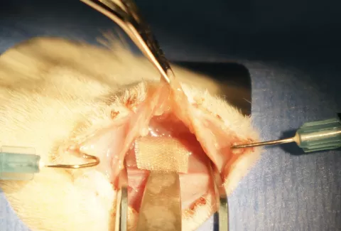 pillar-1-minimally-invasive-cell-transplantation-strategies